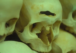 Skull showing result of execution by scimitar thrust